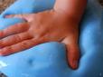 Увага, батьки! Спершу дитина почала кашляти: 4-річна киянка потрапила в реанімацію через мегапопулярну іграшку