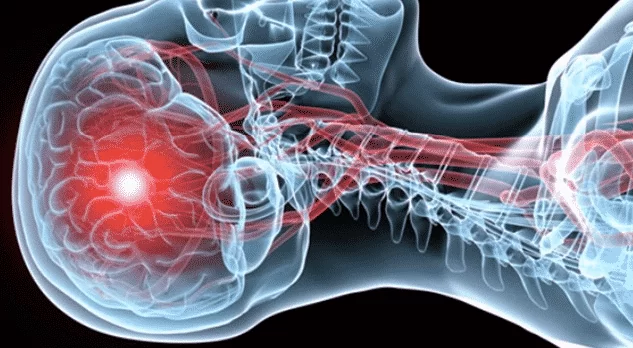 Бережіться! Продукти, які підвищують ризик інсульту чи інфаркту - ви точно таке купували